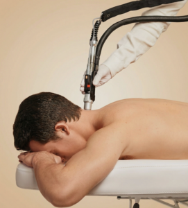 Laser hair removal treatment on the back at Skin Anthology in West Hollywood