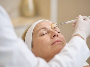 Woman lying back with eyes closed as a fan brush applies solution to her forehead